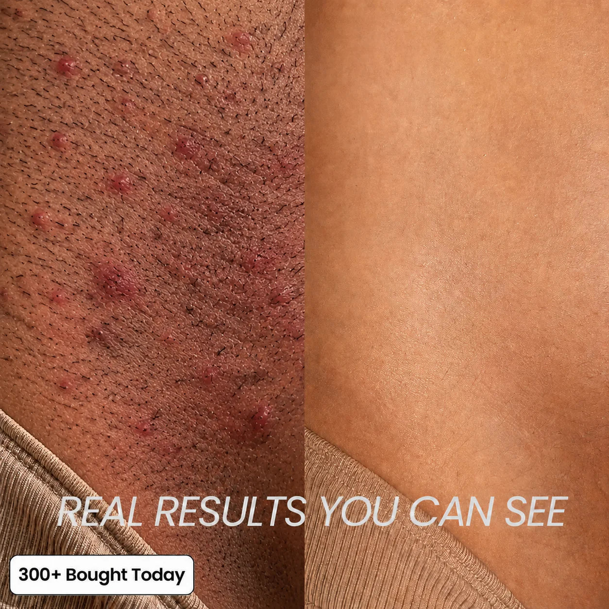 NudeSeoul Anti-Hair Growth Oil