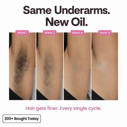 NudeSeoul Anti-Hair Growth Oil